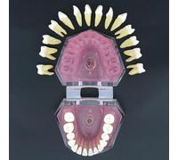 AMITD Life-Size 28-Teeth Dental Model w/Removable Soft Gum - Student & Clinic Demo