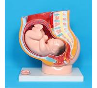 AMITD Lot de 4 pelvis de grossissement avec fœtus amovible pour l'enseignement OB/GYN