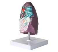 AMITD Modèle 2:3 Smoke Lung w/Pathology, outil pédagogique anatomique humain pour communiquer les médecins et les patients