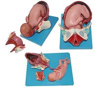 AMITD Modèle anatomique Pelvis & Fœtus pour enfant, 3 étapes de laboratoire, peint à la main, 3 pièces