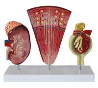 AMITD Modèle d'anatomie néphron et glomérule précis pour l'éducation médicale