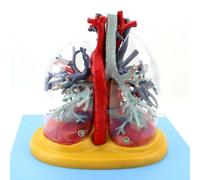 AMITD Modèle d'arbre bronchique en forme de cœur de taille réelle pour l'enseignement cardio-thoracique