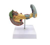 AMITD Modèle de pathologie de pancréas duodénum de taille réelle - Affichage d'enseignement