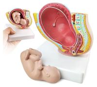 AMITD Modèle Pelvis prégnant 1/2 avec fœtus de 9 mois, 2 pièces, pour affichage de salle de classe