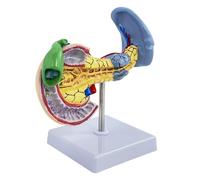 AMITD Pancreas pathologiques, Spleen, Gallbladder & Duodénum Model for Anatomy Study