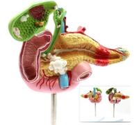 AMITD Patho Pancreas-Spleen-Duodénum Taille de vie Modèle pour entraînement moyen