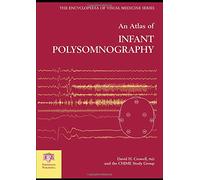 An Atlas of Infant Polysomnography