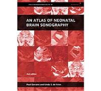 An Atlas of Neonatal Brain Sonography, Clinics in Developmental Medicine Paul Govaert (Auteur)