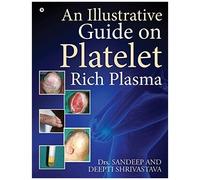 An Illustrative Guide On Platelet Rich Plasma