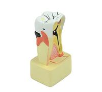 Analyse pratique des dents de pathologie modèle 4 pour l'enseignement des dentistes cliniques dentaires Modèle de dents d'enfant Module d'étude de pathologie dentaire Module pour la science médicale
