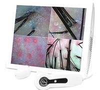 Analyseur De Cheveux 15 Pouces, Détecteur De Cuir Chevelu, Grande Mémoire 32g/Grossissement 200x + Spectre 70 X Trois, Testeur De Follicule Capillaire pour Magasins De Beauté, Salons