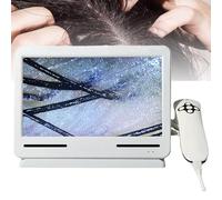 Analyseur de Cheveux de Diagnostic de Peau cheveux peau, professionnel, microscope du cuir chevelu, opération simple