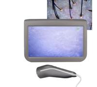 Analyseur de Cheveux de Diagnostic de Peau, Machine D'analyse de Peau 10,1 Pouces Type de Charge Cuir Chevelu Follicule Pileux Peau Détecteur de Cheveux Analyseur Machine Numérique Détecteur