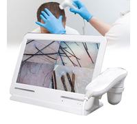 Analyseur de Cheveux de Diagnostic de Peau peau poils, scanner numérique, analyse de santé