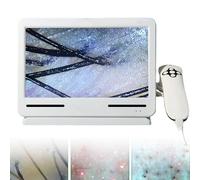 Analyseur de cheveux et de cuir chevelu multifonctionnel rechargeable de 10,1 pouces pour le diagnostic de la peau et du cuir chevelu. Idéal pour une utilisation à domicile ou en salon.