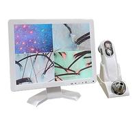 Analyseur de cheveux et de peau pour le diagnostic cutané, écran LCD 15,5 pouces, détecteur numérique, analyseur de follicules pileux multifonctionnel, microscope testeur à écran LCD HD pour