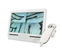 Analyseur de cuir chevelu pour le diagnostic cutané et capillaire, avec deux lentilles grossissantes 50x et 200x, pour l'analyse du sébum et de l'humidité des follicules.