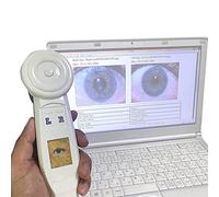 Analyseur D'iris De Caméra HD Iris Caméra D'iridologie Avec Objectif Hd 30x Iris, Détecteur D'iris De Type Ordinateur 2 Millions De Pixels, Interrupteur D'éclairage Gauche Et Droit, Loupe D'iris
