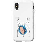 Anatomie de Grossesse fœtus dans Utero OBGYN Sage-Femme Coque pour iPhone X/XS