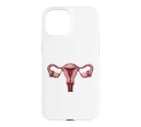 Anatomie de l'utérus OB GYN Gynécologie Illustration médicale Coque pour iPhone 15