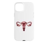 Anatomie de l'utérus OB GYN Gynécologie Illustration médicale Coque pour iPhone 15 Plus