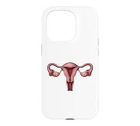 Anatomie de l'utérus OB GYN Gynécologie Illustration médicale Coque pour iPhone 15 Pro