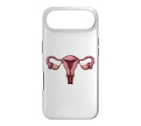 Anatomie de l'utérus OB GYN Gynécologie Illustration médicale Coque pour iPhone Air