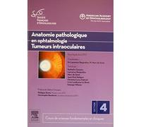 Anatomie pathologique en ophtalmologie : Tumeurs intraoculaires