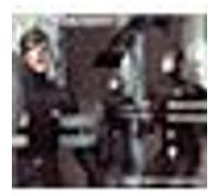 Anesthésie internationale