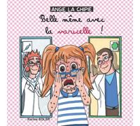 ANGIE LA CHIPIE Belle même avec la varicelle !