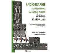 Angiographie Par Résonance Magnétique (Arm) Cérébrale Et Médullaire - Techniques, Indications, Résultats, Variantes Et Pièges