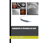 Angioplastie et thrombose de stent
