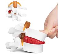 ANNWAN Modèle de hernie discale - Modèle de hernie discale lombaire humaine pour l'enseignement et l'étude