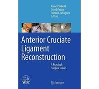 Anterior Cruciate Ligament Reconstruction