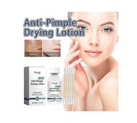 Anti-Pimple Drying Lotion, Spot Treatment with Zinc Oxide, AHA Lotion for Drying Pimples, Acne Spot Treatment Dries Out Pimples