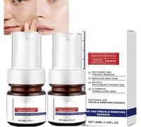 Anti-Spot Serum,Whitening and Freckle Removing Essence, 30ml Magic Whitening Spot Cream, Spot Remover for Face, Vitamin C Whitening Freckle Cream, Dark Spot Removal, for All Skin Types (2)
