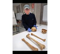 ANTROPOMETRÍA, DIMORFISMO SEXUAL Y OTROS TRABAJOS DE ANTROPOLOGÍA FORENSE: Anthropometry, Sexual Dimorphism and other works of Forensic Anthropology