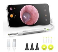 AnyScope Otoscope numérique avec gyroscope, caméra auriculaire HD avec outils de retrait du cérumen, otoscope auditif vidéo avec lumière, compatible avec iPhone et Android (argent)