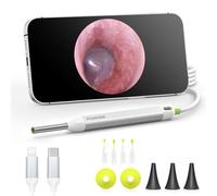 AnyScope Otoscope numérique HD, otoscope auditif vidéo avec lumière, caméra auriculaire ultra claire avec outils de retrait du cérumen, compatible avec les appareils iPhone et Android (argent)