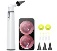 AnyScope Otoscope sans fil avec gyroscope, caméra auriculaire avec double vue, otoscope de 3,9 mm avec lumière, lunette d'oreille avec outil de retrait de cérumen pour enfants, adultes et animaux