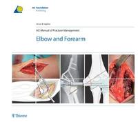Ao Manual Of Fracture Management