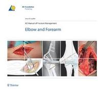 AO Manual of Fracture Management Elbow Forearm by Jesse Jupiter Jesse Jupiter (Auteur)