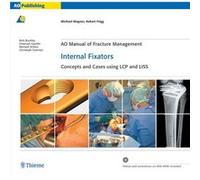 AO Manual of Fracture Management Internal Fixators by Robert Frigg Wagner, Michael, Frigg, Robert (Auteur)