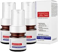 Aobenz Anti Spot Serum, Aobenz Whitening And Freckle Removing Essence,Vitamin C Blemish Serum For Face,Magic Whitening Spot Cream, Dark Spot Correcting Serum,Brightening and Removing Freckles (3 Pcs)
