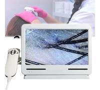 Appareil d'analyse du Cuir chevelu Analyseur de cheveux sébum pour le diagnostic cutané, de mesure de l'humidité la sécrétion des follicules pileux, pour améliorer l'état pour la détection e