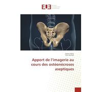 Apport de l’imagerie au cours des ostéonécroses aseptiques