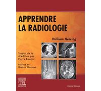 Apprendre la radiologie