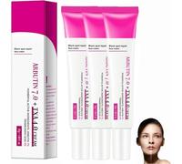 Arbutin 7% + Tranexamic Acid 4% Cream, Powerful Black Skin Lightening Cream, Even Out Tone, Anti-Pigmentation, Black Spot Repair Face Cream, Reduce Freckles (3)