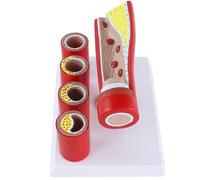 Artère Cardiovasculaire Modèle Semblable À Une Artère Coronaire Modèle Anatomique Vasculaire Pathologique D'enseignement Humain - Modèle De Thrombose De Formation De Sclérose