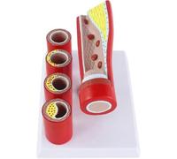 Artère cardiovasculaire Modèle semblable à une artère coronaire Modèle anatomique vasculaire pathologique d'enseignement humain - Modèle de thrombose de formation de sclérose d'artère de branche âgée